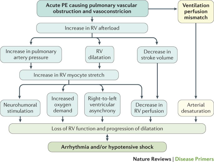 Pulmonary Embolism Nature Reviews Disease Primers