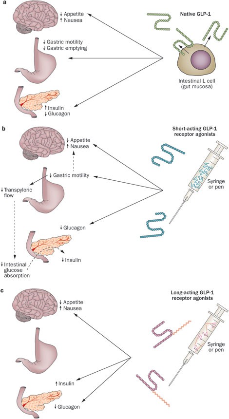 icer glp-1 The President Weighs In: Improving Access And Affordability Of Obesity  Medications