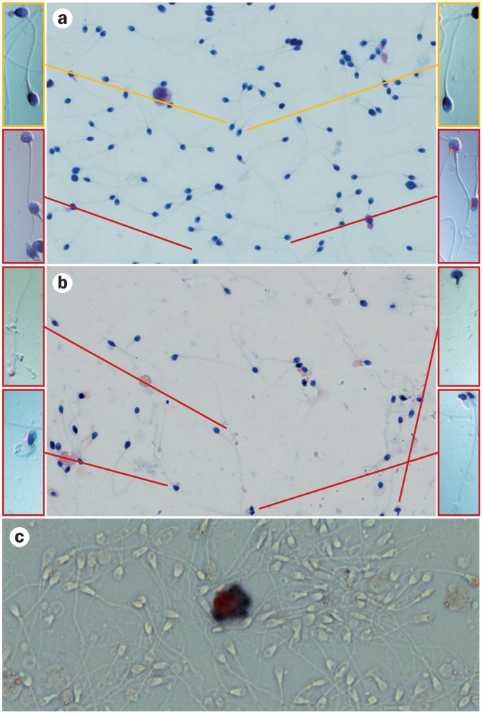 Possible Fetal Determinants Of Male Infertility Nature Reviews Endocrinology Possible Fetal Determinants Of Male Infertility Nature Reviews Endocrinology