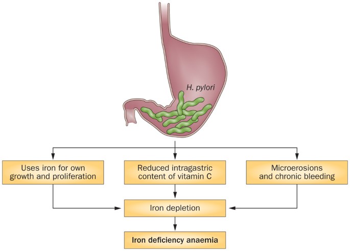 Clinical effects of Helicobacter pylori outside the stomach | Nature  Reviews Gastroenterology & Hepatology