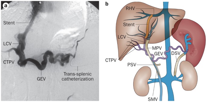 Smv medical abbreviation