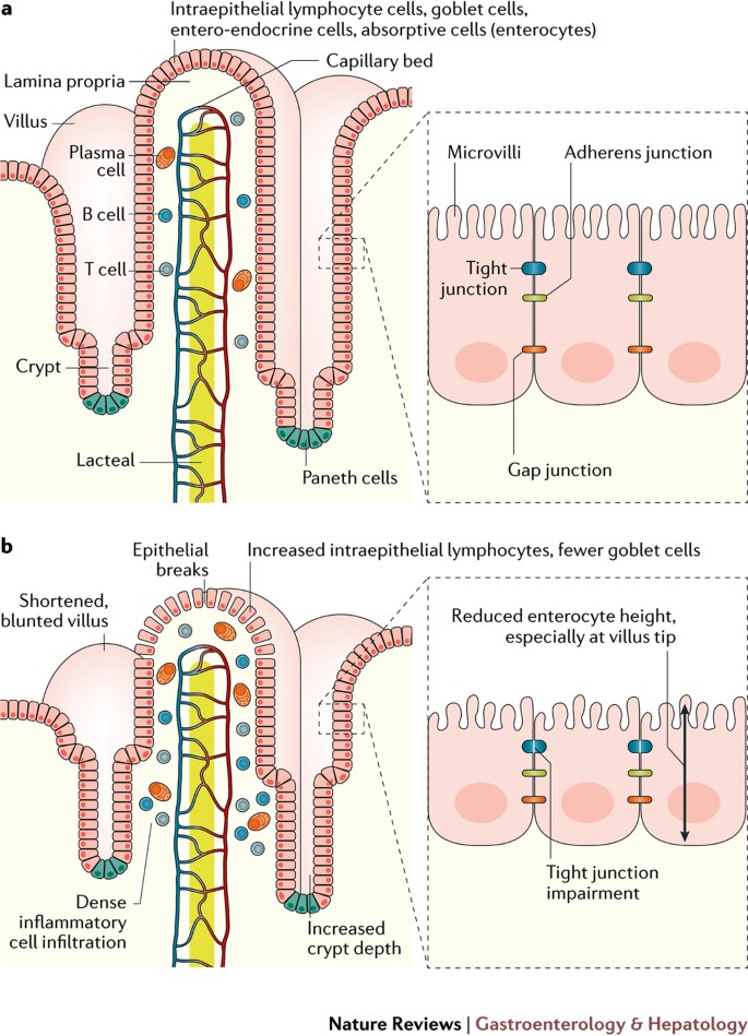 The potential role of optical biopsy in the study and diagnosis of  environmental enteric dysfunction | Nature Reviews Gastroenterology &  Hepatology