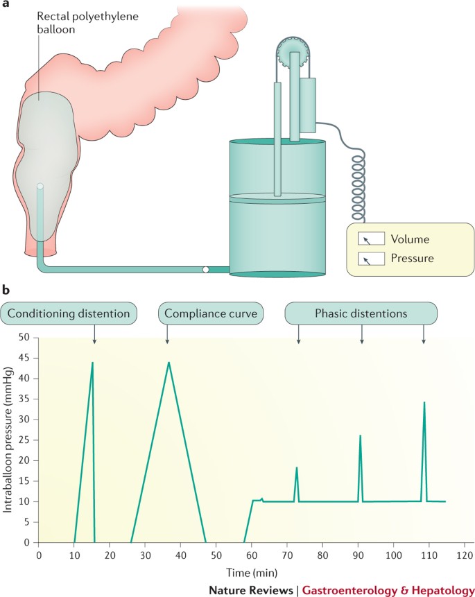 Advances in the evaluation of anorectal function | Nature Reviews  Gastroenterology & Hepatology