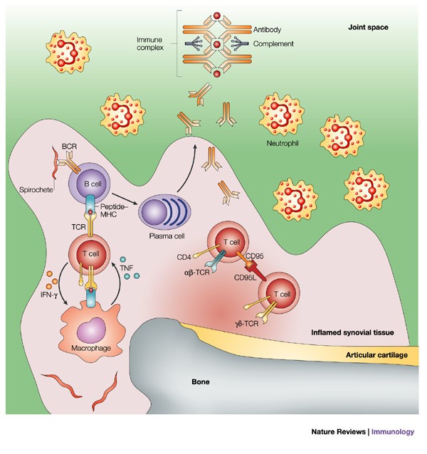 Elucidation of Lyme arthritis