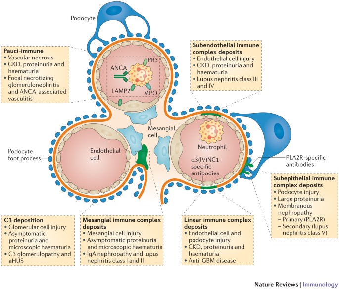 The immune system and kidney disease: basic concepts and clinical  implications