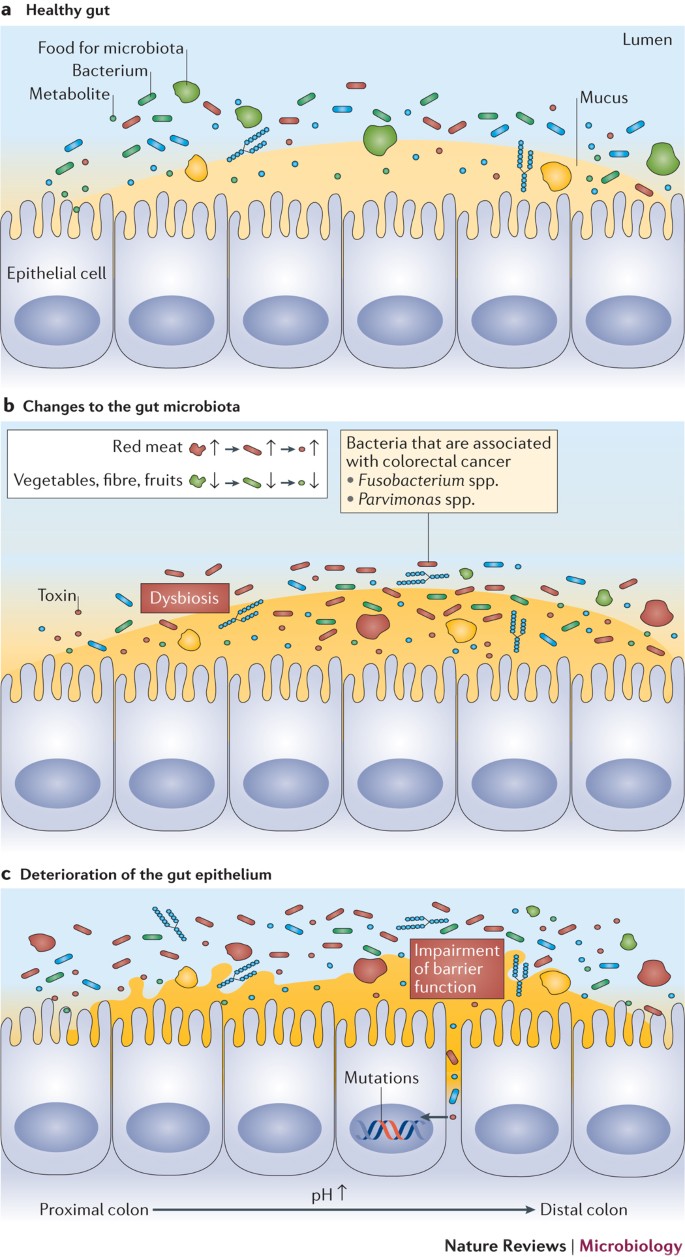 Metagenome Wide Association Studies Fine Mining The Microbiome Nature Reviews Microbiology