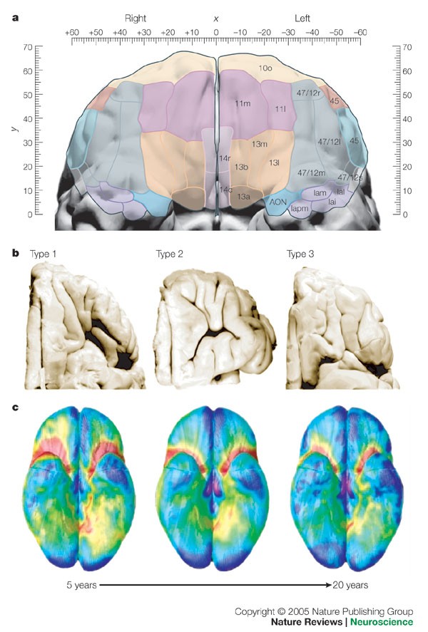 Chronic Pain Linked to Brain Signals in Orbitofrontal Cortex - The