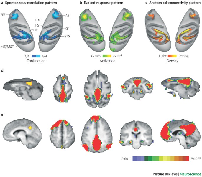 Spontaneous fluctuations in brain activity observed with