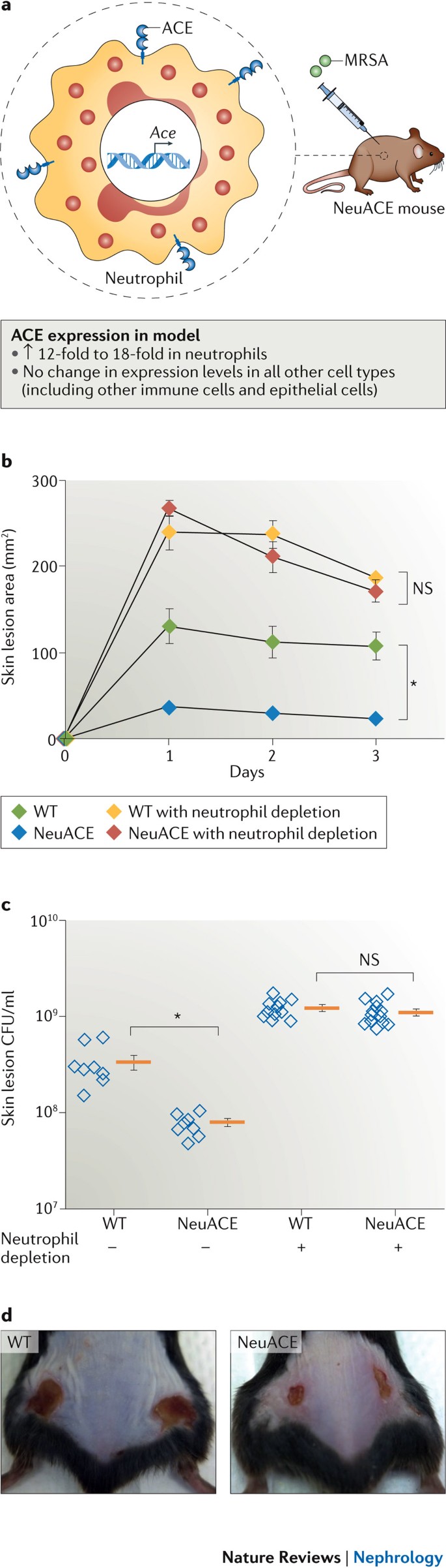 Angiotensin-converting enzyme in innate and adaptive immunity | Nature  Reviews Nephrology