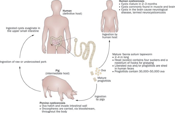 Diagnosis and treatment of neurocysticercosis | Nature Reviews Neurology