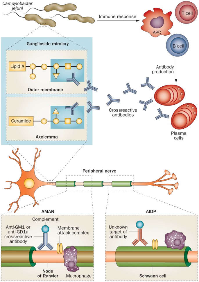 Guillain Barre Syndrome Pathogenesis Diagnosis Treatment And Prognosis Nature Reviews Neurology