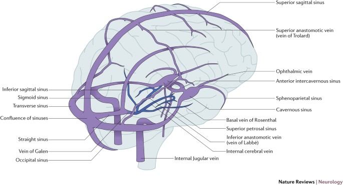 Cerebral Venous Thrombosis Nature Reviews Neurology