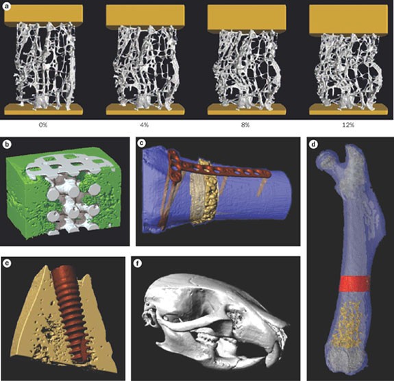 Hierarchical Microimaging Of Bone Structure And Function Nature Reviews Rheumatology