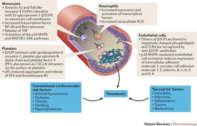 Diagnosing antiphospholipid syndrome: 'extra-criteria' manifestations and  technical advances | Nature Reviews Rheumatology