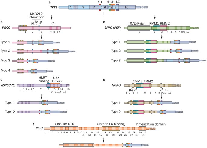 Molecular Genetics And Cellular Features Of Tfe3 And Tfeb Fusion Kidney Cancers Nature Reviews Urology