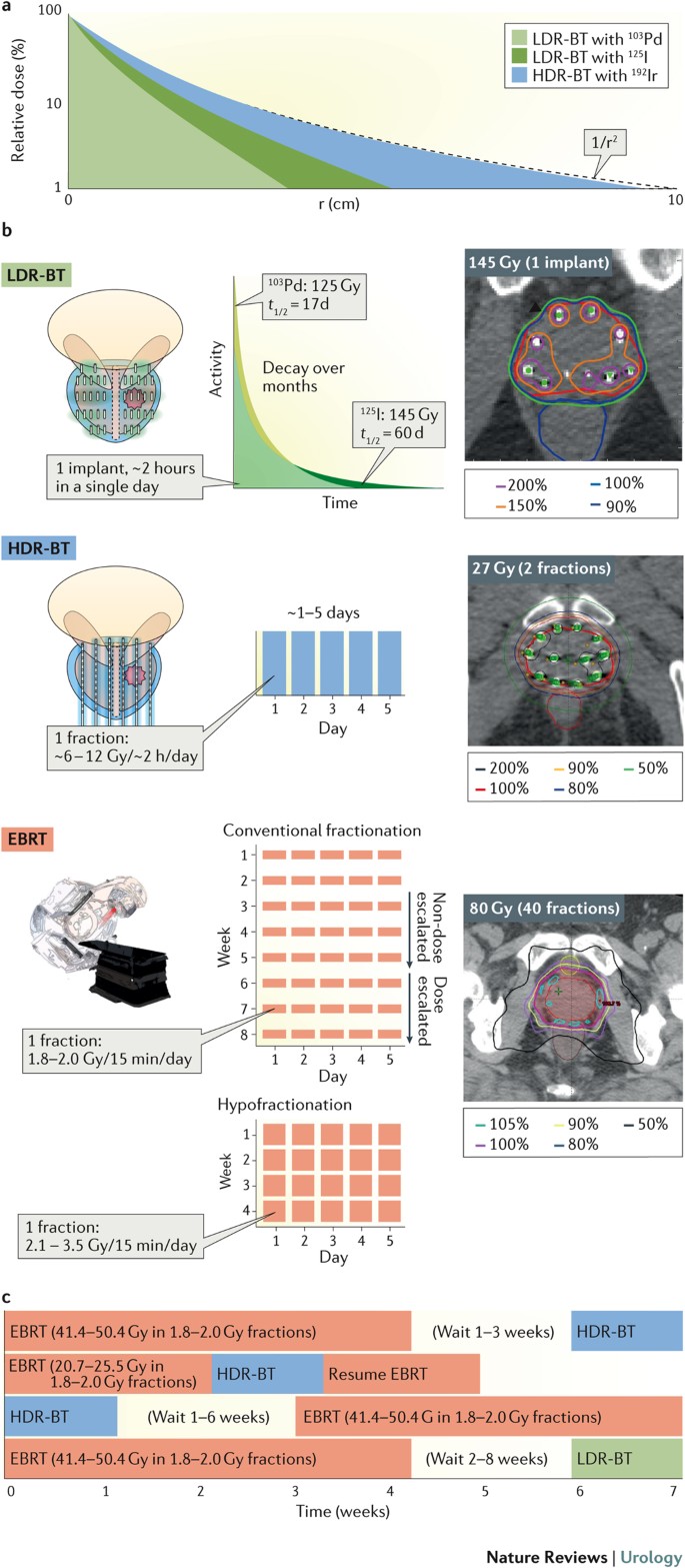 The Evolution Of Brachytherapy For Prostate Cancer Nature Reviews Urology