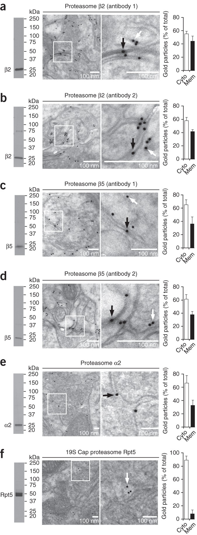 A Mammalian Nervous System Specific Plasma Membrane Proteasome Complex That Modulates Neuronal Function Nature Structural Molecular Biology A Mammalian Nervous System Specific Plasma Membrane Proteasome Complex That Modulates Neuronal Function Nature Structural Molecular Biology