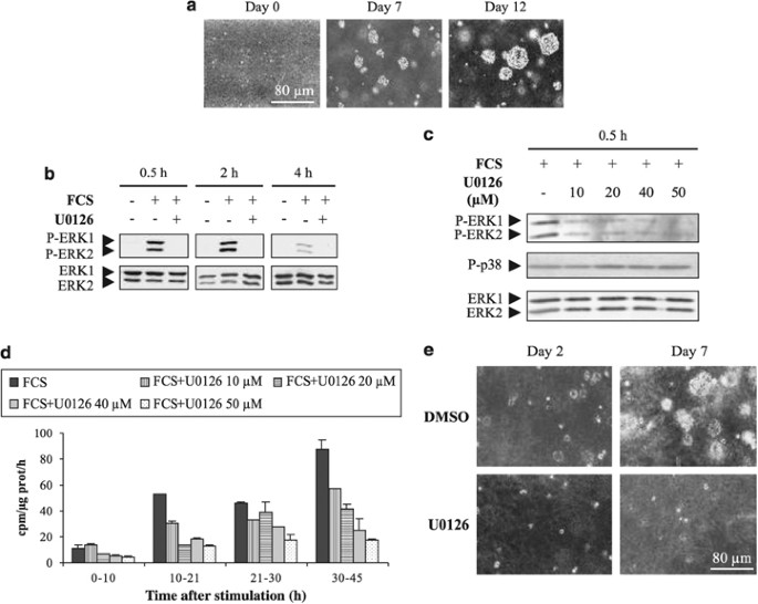RNAi-mediated ERK2 knockdown inhibits growth of tumor cells in vitro and in  vivo | Oncogene