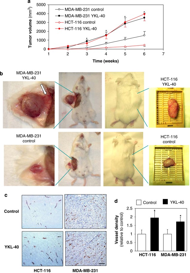 Ykl 40 A Secreted Glycoprotein Promotes Tumor Angiogenesis Oncogene