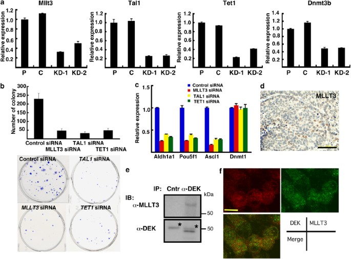 DEK oncoprotein regulates transcriptional modifiers and sustains tumor  initiation activity in high-grade neuroendocrine carcinoma of the lung |  Oncogene