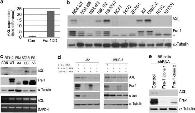 Fra 1 Controls Motility Of Bladder Cancer Cells Via Transcriptional Upregulation Of The Receptor Tyrosine Kinase Axl Oncogene