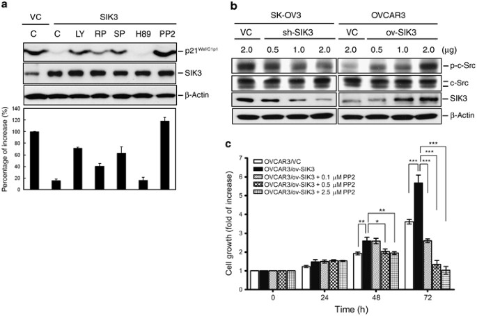 Downregulated Salt Inducible Kinase 3 Expression Promotes Chemoresistance In Serous Ovarian Cancer Via The Atp Binding Cassette Protein Abcg2