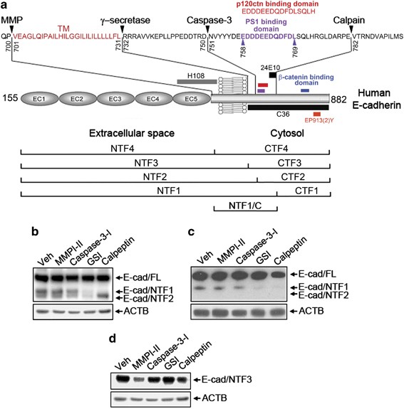 The Genesis And Unique Properties Of The Lymphovascular Tumor Embolus Are Because Of Calpain Regulated Proteolysis Of E Cadherin Oncogene