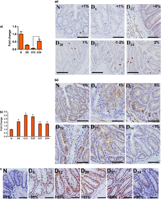 Utility Of A Bacterial Infection Model To Study Epithelial Mesenchymal Transition Mesenchymal Epithelial Transition Or Tumorigenesis Oncogene