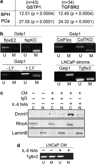 A Reciprocal Role Of Prostate Cancer On Stromal Dna Damage Oncogene