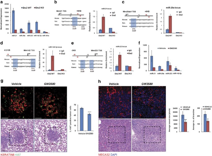 Csf1 Ets2 Induced Microrna In Myeloid Cells Promote Metastatic Tumor Growth Oncogene