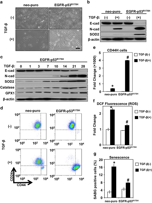 Mitochondrial Sod2 Regulates Epithelial Mesenchymal Transition And Cell Populations Defined By Differential Cd44 Expression Oncogene