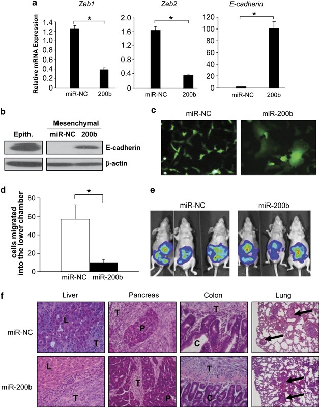 miR-200b restoration and DNA methyltransferase inhibitor block lung  metastasis of mesenchymal-phenotype hepatocellular carcinoma | Oncogenesis
