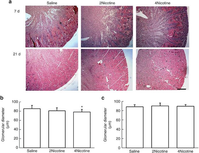 cigarette effects on kidney Maternal nicotine exposure during gestation and lactation induces kidney  injury and fibrosis in rat offspring