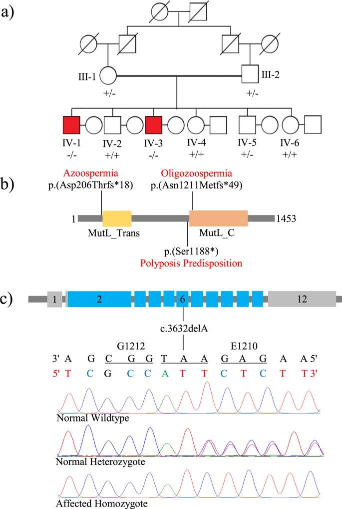 A Loss Of Function Variant In Dna Mismatch Repair Gene Mlh3 Underlies Severe Oligozoospermia Journal Of Human Geics
