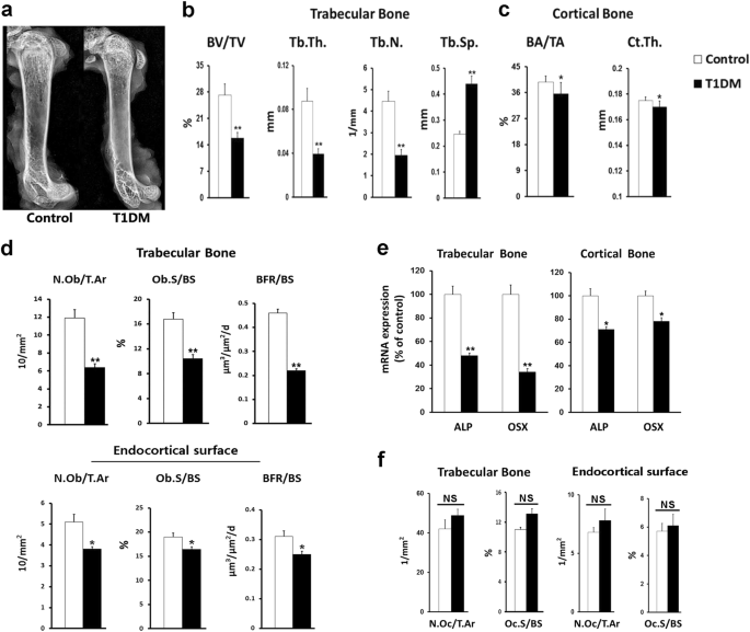 Fig. 1: Streptozotocin (STZ)-induced T1DM mice showed a greater extent of osteopenia in cancellous bone than in cortical bone.