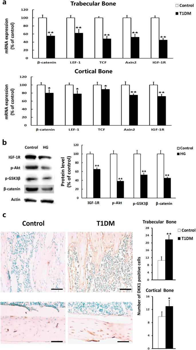 Fig. 2: T1DM mice exhibited greater downregulated expression level of WNT/β-catenin signaling in trabecular bone than in cortical bone through inhibition of IGF-1R/Akt/GSK3β pathway.