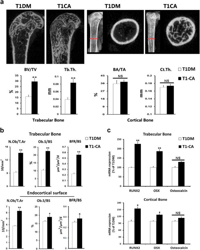 Fig. 3: Osteoblastic activation of β-catenin in T1DM mice led to greater extent of bone mass increment and increase of osteogenic activities in trabecular bone compared with cortical bone.