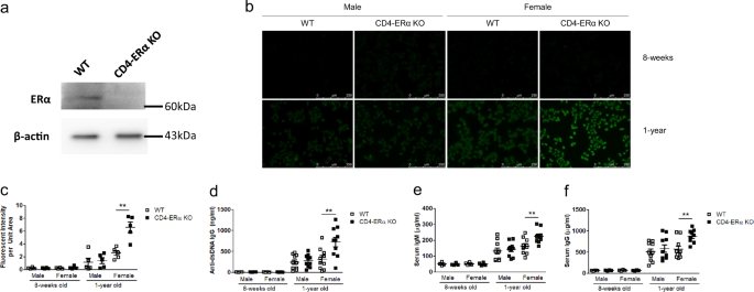 Fig. 1: One-year-old CD4-ERα knockout female mice developed spontaneous mild autoimmune phenotypes.