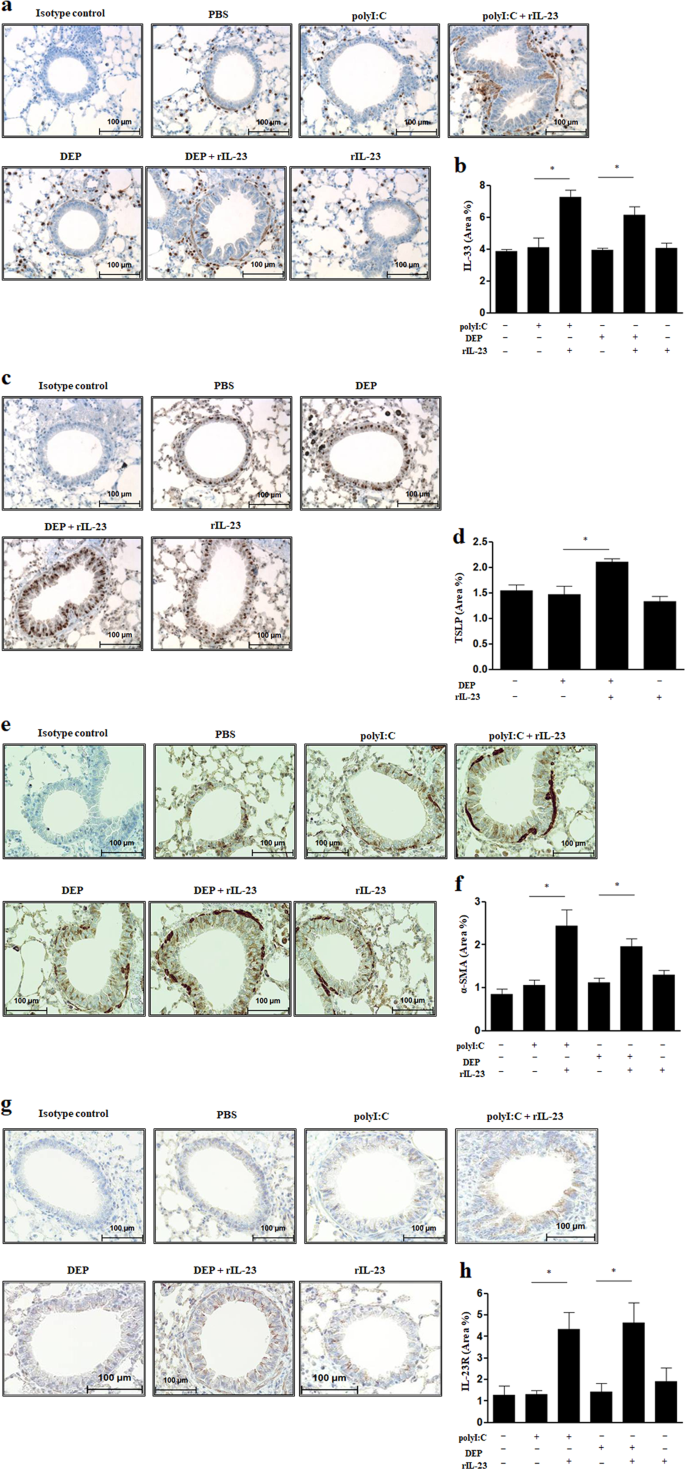 Role Of Interleukin 23 In The Development Of Nonallergic Eosinophilic Inflammation In A Murine Model Of Asthma Experimental Molecular Medicine Role Of Interleukin 23 In The Development Of Nonallergic Eosinophilic Inflammation In A Murine Model Of Asthma Experimental Molecular Medicine