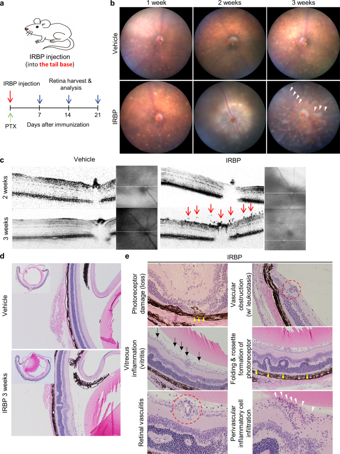 Fig. 1: Interphotoreceptor retinoid-binding protein (IRBP)-immunized mice present perivascular inflammation.