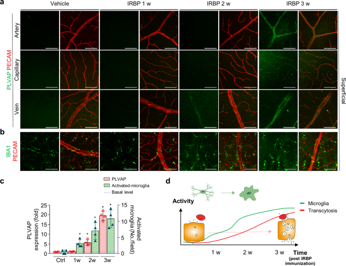 Fig. 3: Activation of perivascular microglia precedes increased transcytosis in retinal vessels in interphotoreceptor retinoid-binding protein (IRBP)-induced retinal vasculitis.