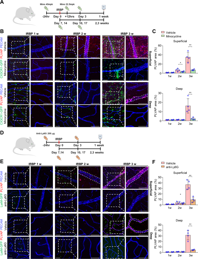Fig. 4: Immune cell suppression ameliorates transcytosis in the retinas of mice with interphotoreceptor retinoid-binding protein (IRBP)-immunized.