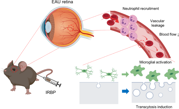 Fig. 8: Schematic illustration showing the process of retinal vascular pathology in interphotoreceptor retinoid-binding protein (IRBP)-induced experimental autoimmune uveitis.