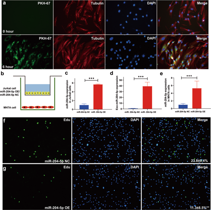 Fig. 3: Exosomal miR-204-5p from human T lymphocytes is transferred to synovial fibroblasts.