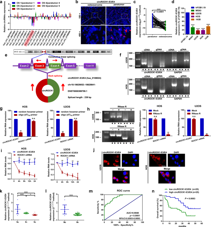 Fig. 1: CircROCK1-E3/E4 is downregulated and associated with poor prognosis in patients with osteosarcoma.