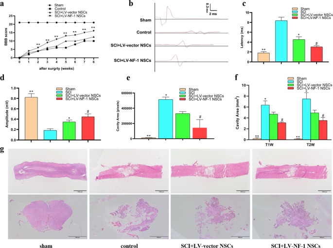 Fig. 3: Transplantation of NF-1 knockout neural stem cells (NSCs) enhanced neurological recovery and reduced lesion volume in rats after spinal cord injury.