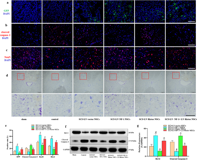 Fig. 4: Transplantation of neural stem cells (NSCs) with NF-1 knockout alleviated apoptosis and enhanced the survival of residual neurons.