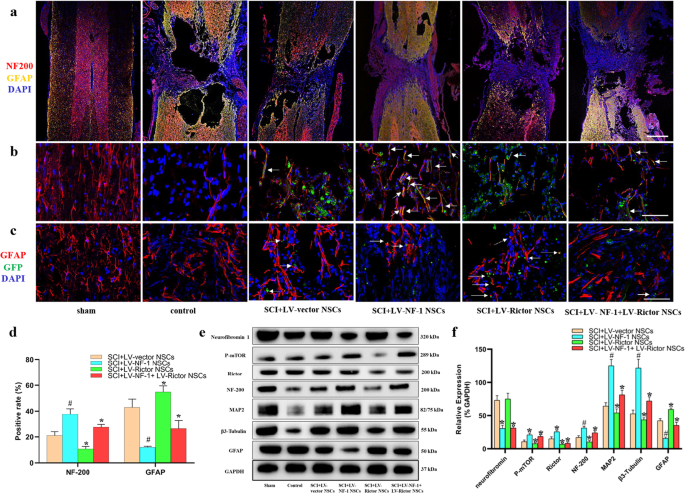 Fig. 5: Knockout of NF-1 improved neuronal differentiation and enhanced the mTORC2 pathway in transplanted neural stem cells (NSCs) in vivo.