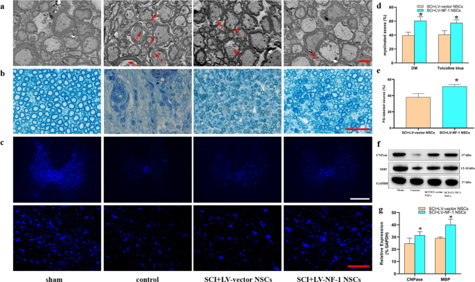 Fig. 6: Transplantation of NF-1 knockout neural stem cells (NSCs) facilitated axonal regeneration.
