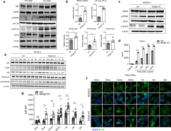 Fig. 5: ERdj5 deficiency causes ER stress and inflammation mediated by NF-κB activation.
